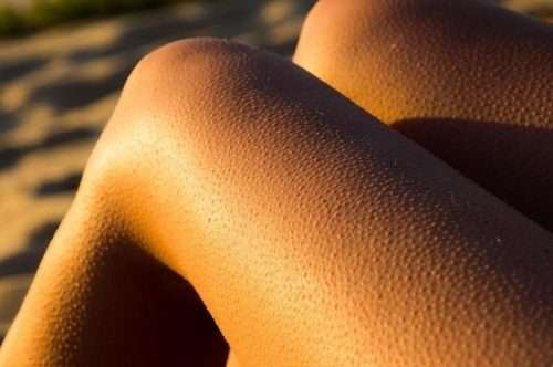 Close-up view of a person’s legs illuminated by the golden hour sunlight, highlighting the visible goosebumps on the skin.