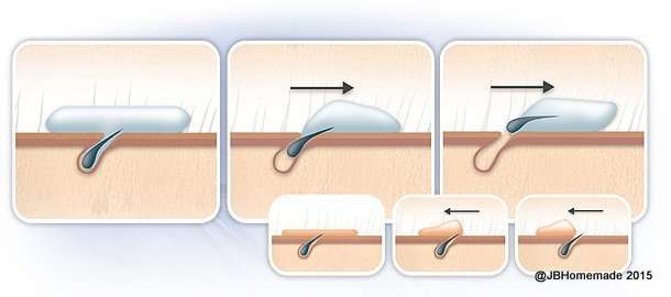 How Sugaring Works graphic: When body sugar paste or wax is applied to the skin, it penetrates the pores on a microscopic level. This process effectively lubricates the hairs and follicles. Why does this matter? Simply put, lubricated hairs are much easier to remove, which leads to a less painful extraction experience.