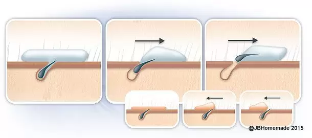How Sugaring Works graphic showing 3 hand drawn closeup illustration steps of a hair follicle being removed from the pore in the direction of growth