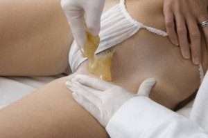 An aesthetician performing the Sugaring technique at the bikini line